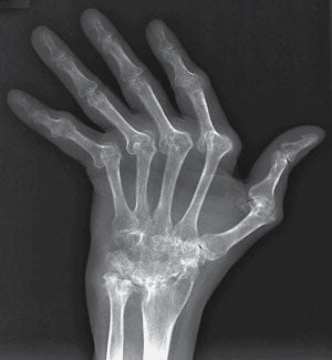 Chiropractic Essentials - NBCE Physiotherapy